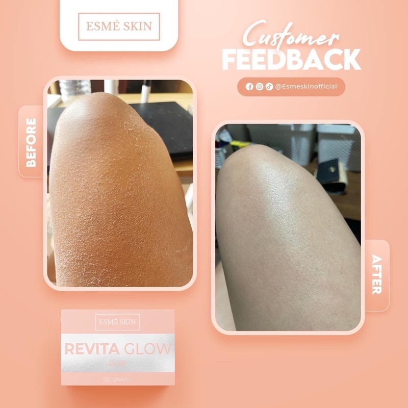 Esme Skin Revita Glow Bar Soap Revitaglow Lazada PH