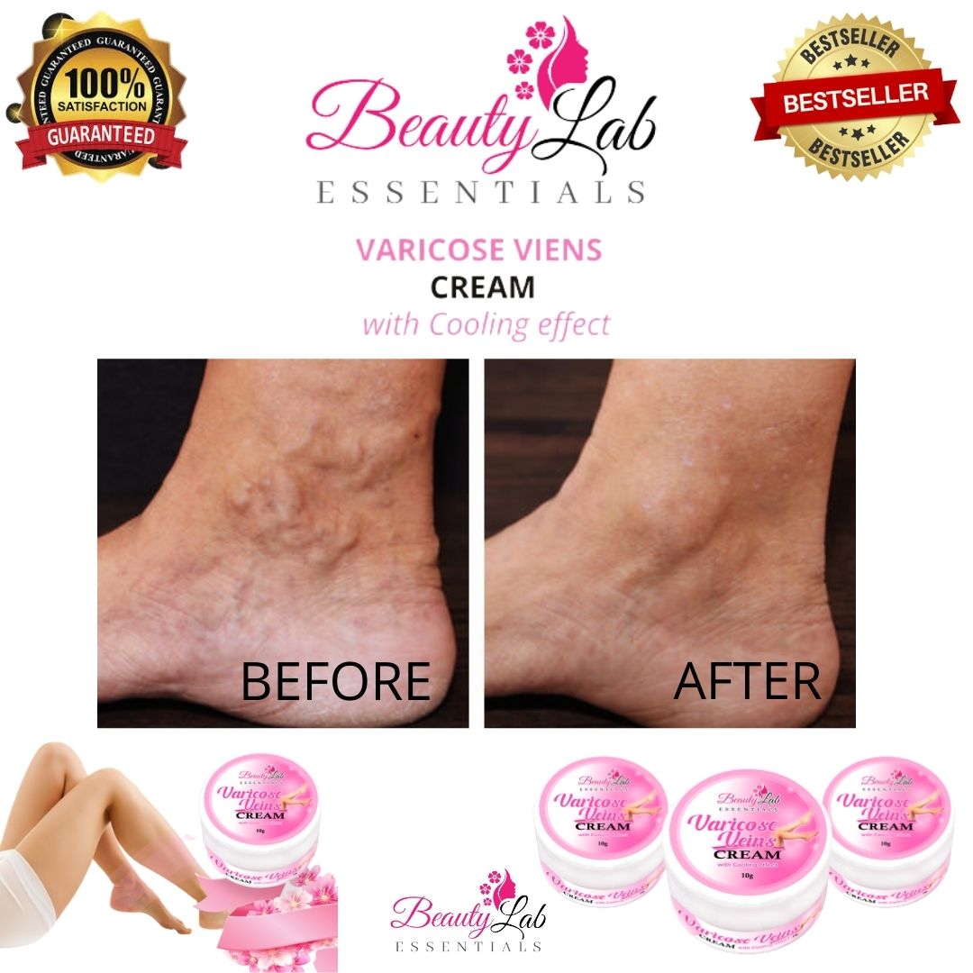 BEAUTY LAB ESSENTIALS Varicose Veins Cream Effective Original With Cooling Effect G Varicose