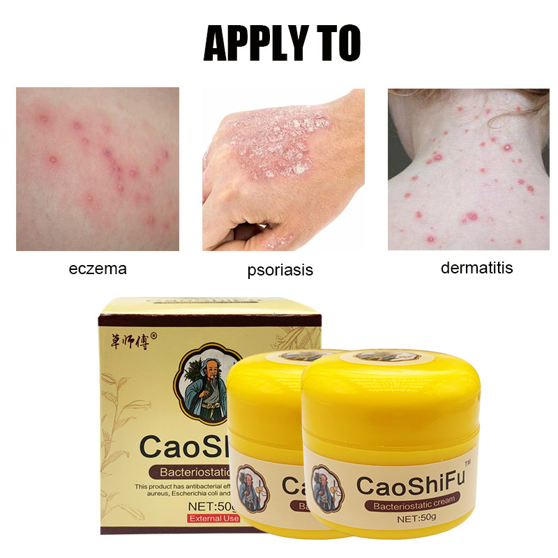 ZB 50g Grass Food Antibacterial Cream Skin Rash Psoriasis Cream Redness