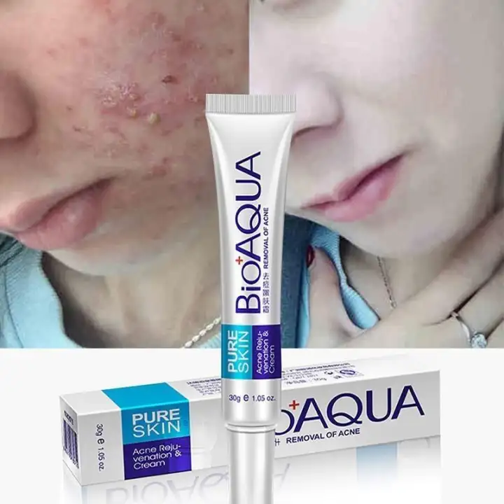 acne reducing cream
