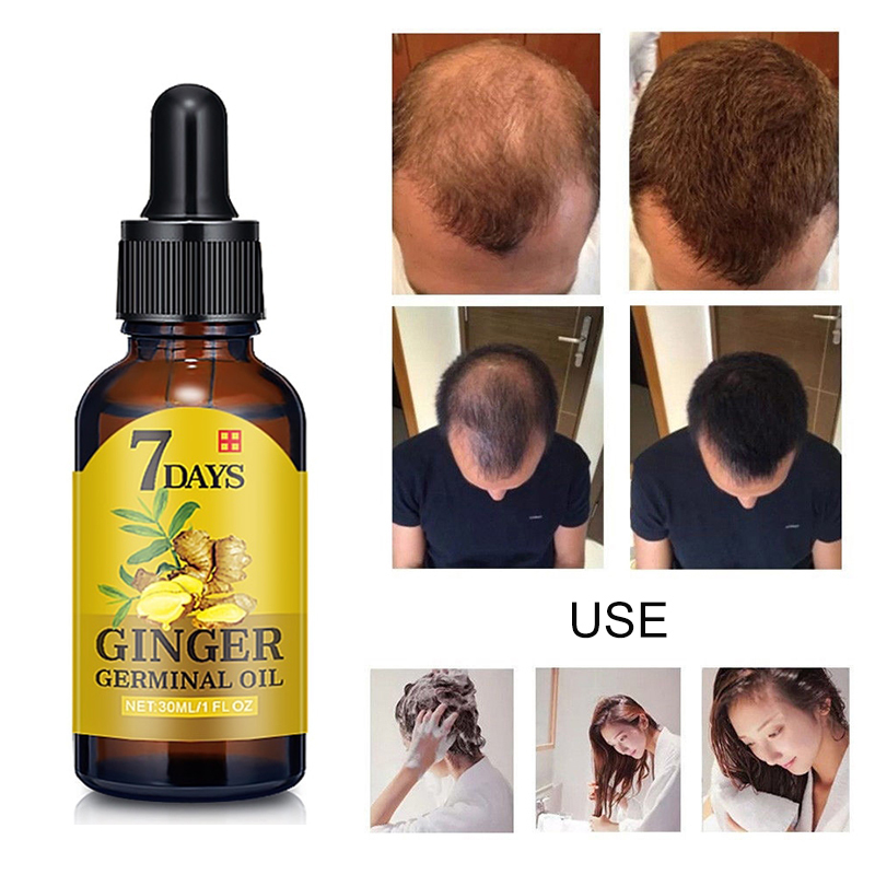 Fast Hair Growth Essence Oil Hair Loss Treatment Help for hair Growth Hair Care 30ml giá rẻ