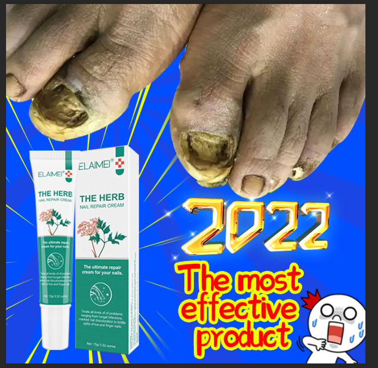 🎉🎉🎉The most effective product💖💖💖 Nail fungus treatment nail repair