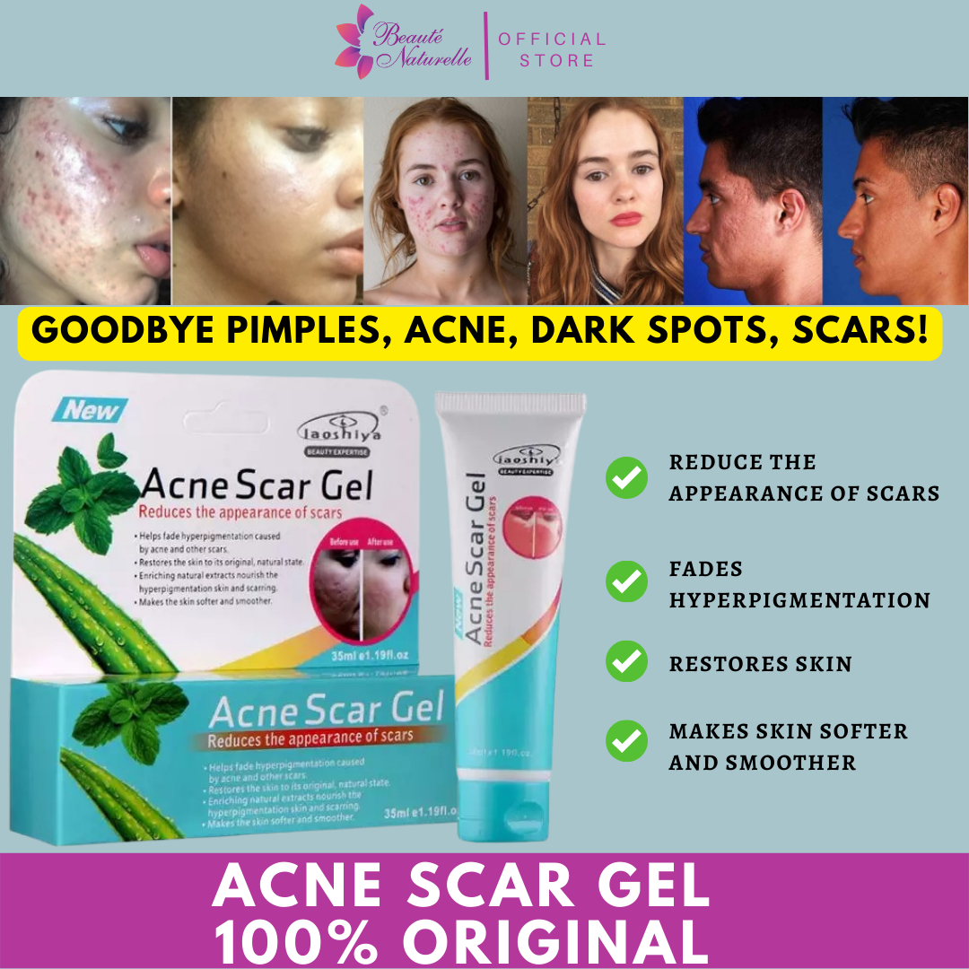 Original Acne Scar Gel Dark Spot Remover Pimple Mark Cream Anti Scar Peklat Anti