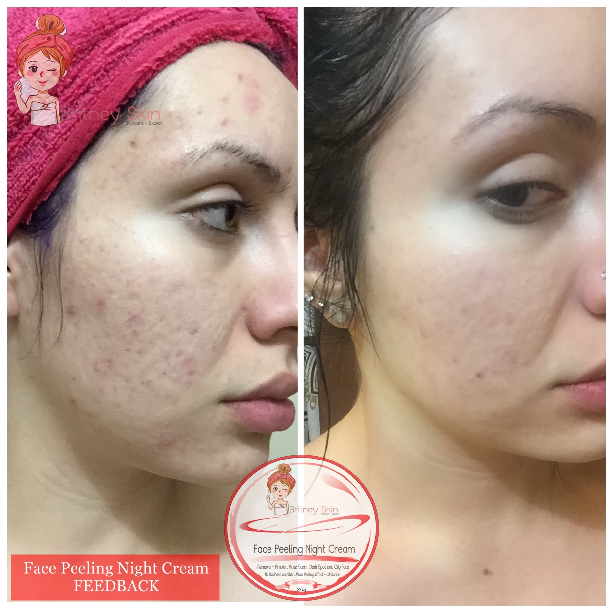 Peeling Face Cream Lazada PH