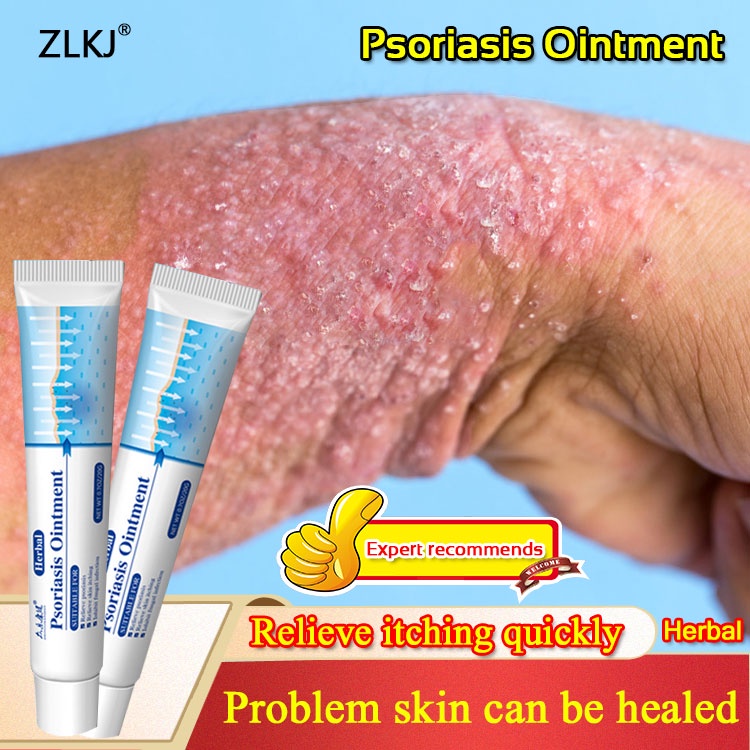 Zlkj Psoriasis Cream Desquamation Treatment for Skin Rash Urticaria