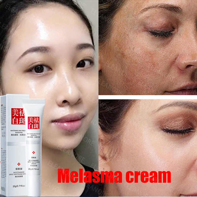 Whitening Freckle Cream Melasma Cream Pekas Remover Dark Spots Remover Brighten Skin AntiAging