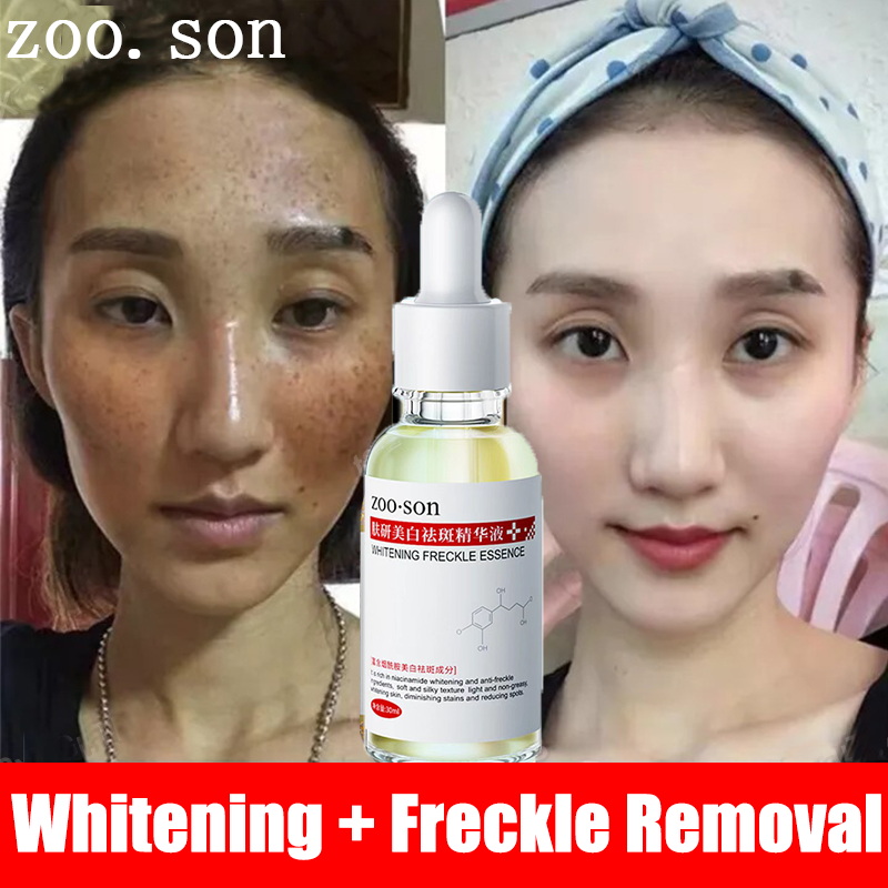 Improve dull complexion Niacinamide anti melasma serum melasma remover from japan/ The United