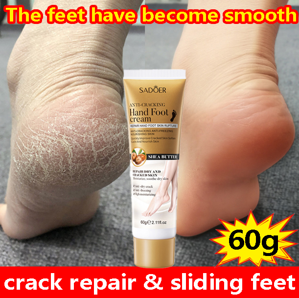 quick fix】hand foot cream 60g Anti Chapping Cracked Feet Heel