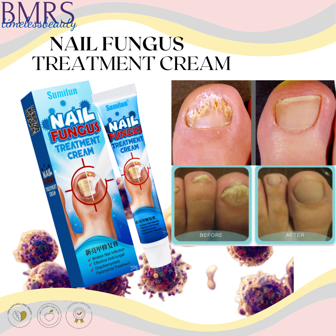 Effective Anti-Fungal | SUMIFUN Nail Fungus Treatment Cream | Nail ...