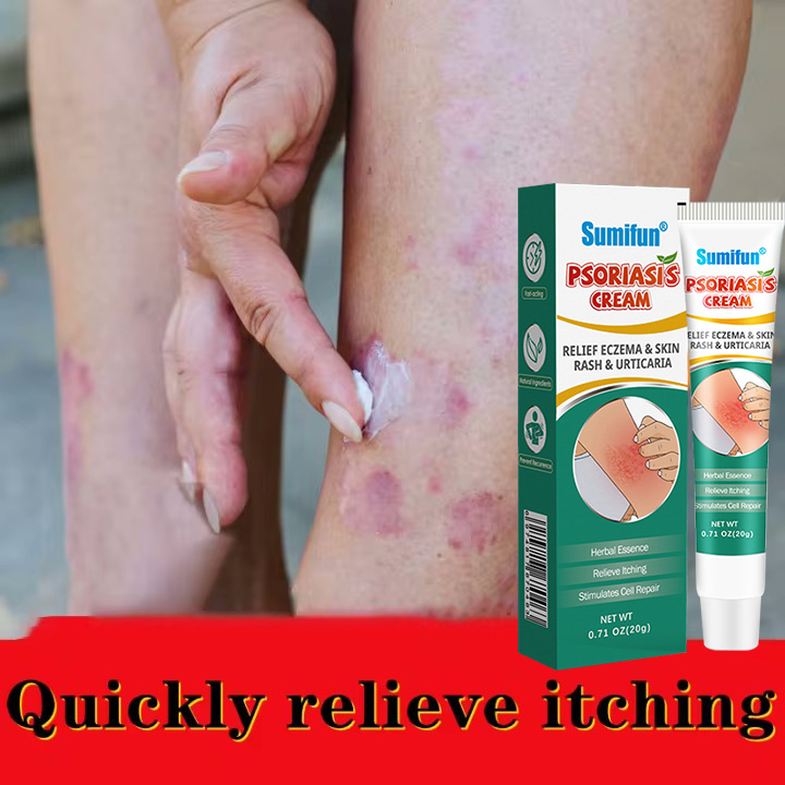 Sumifun Original Psoriasis Eczema Cream Antibacterial Anti-itching ...