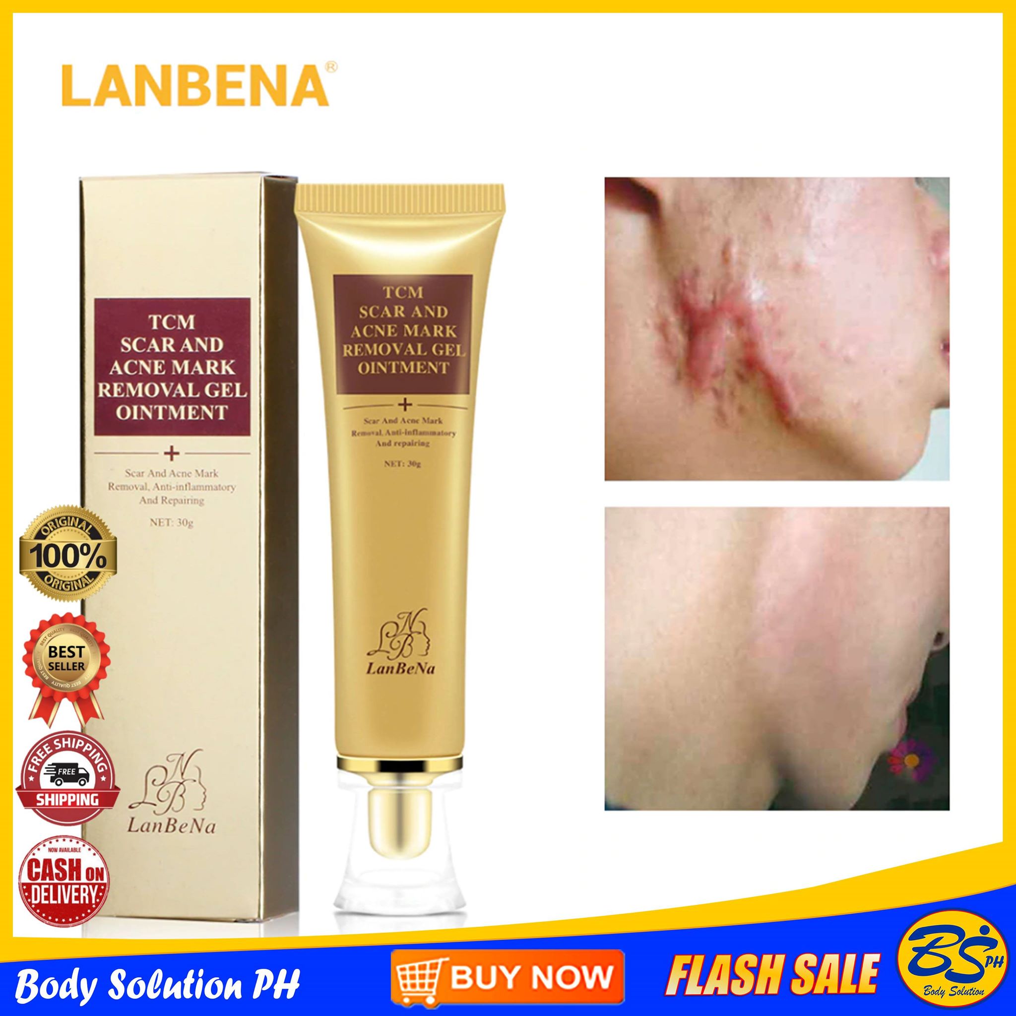 korean blackhead remover cream