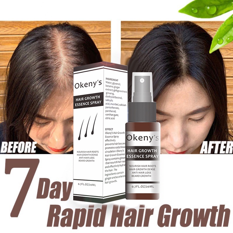 hair growth shampoo spray growniella serum for men goyee hair care set ...