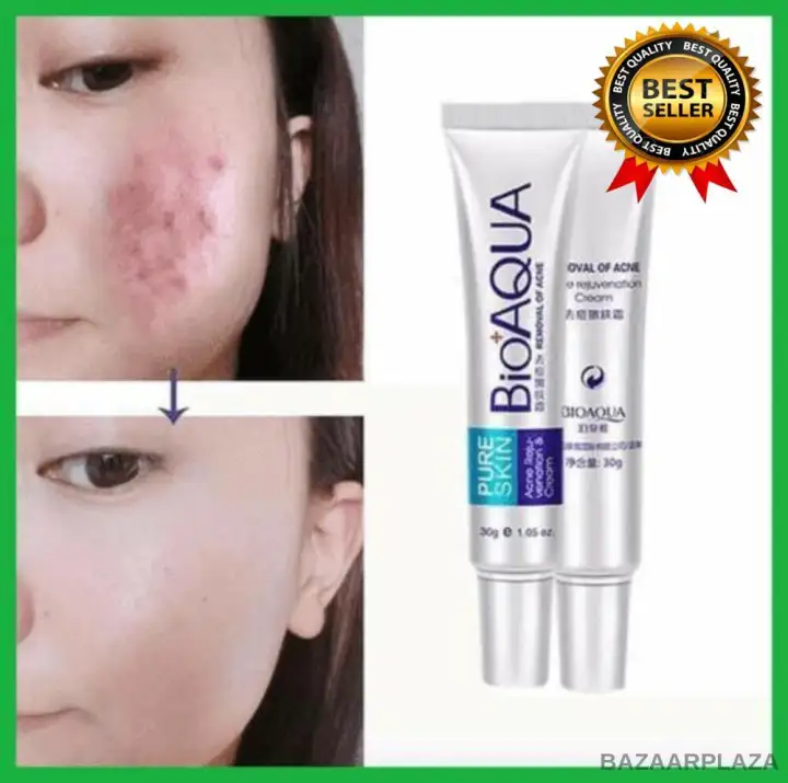 best acne removal