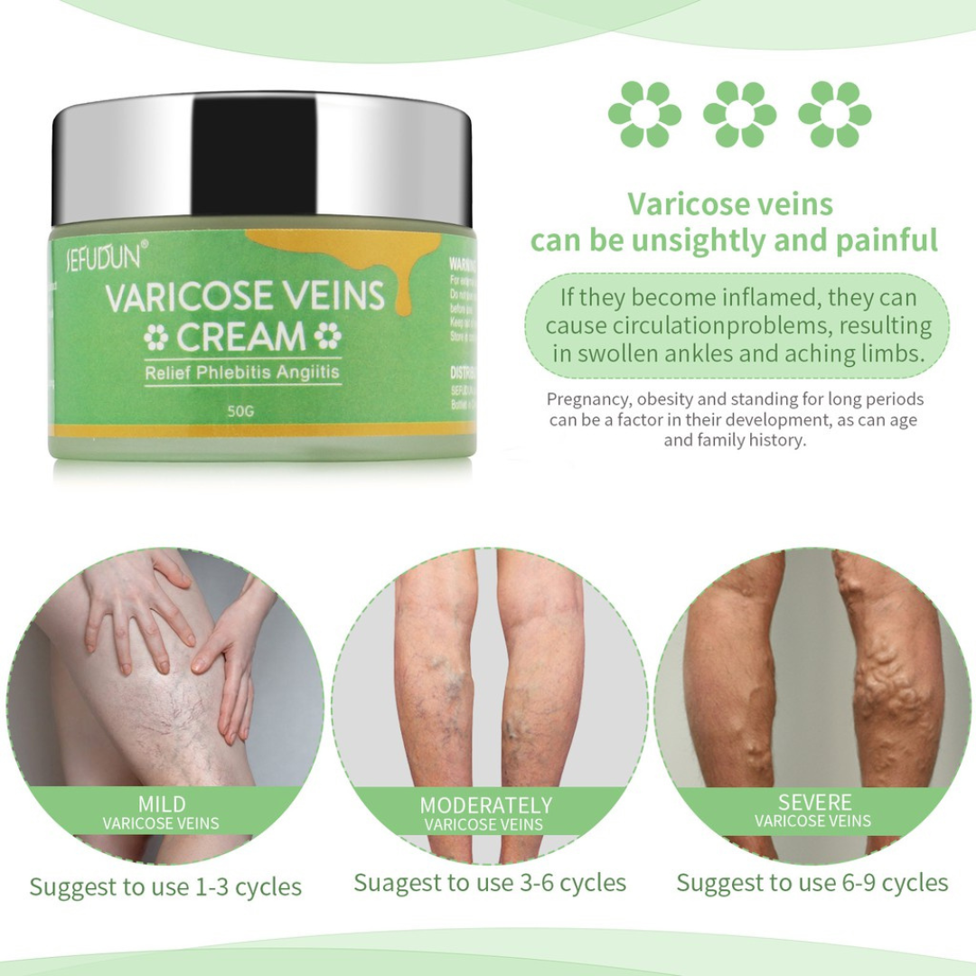 🔥SEFUDUN Varicose Vein Cream Varicose Vein Treatment Cream Effective ...