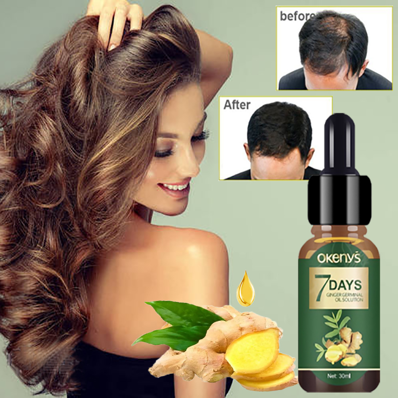 Ginger Hair growth Essence Hair AntiLose Essential Oil Nourishes Scalp Hair Follicles Hair