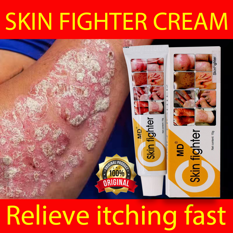 MD SKIN FIGHTER CREAM 15g Stop Itching quickly magic skin cream、chronic