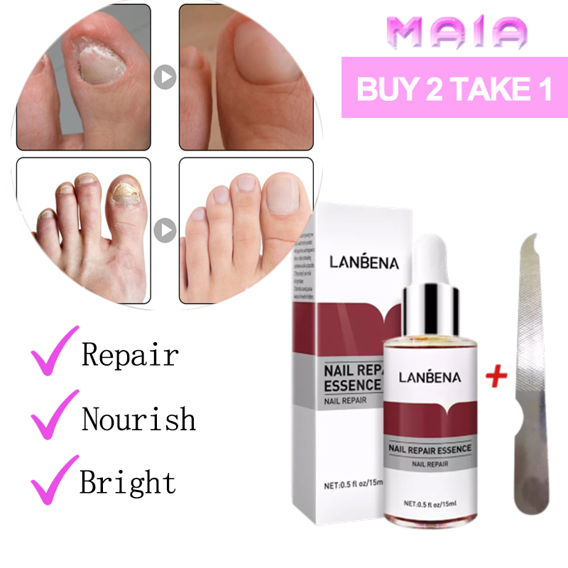LANBENA Nail repair Essence Fungal nail care nail Removal Fungal