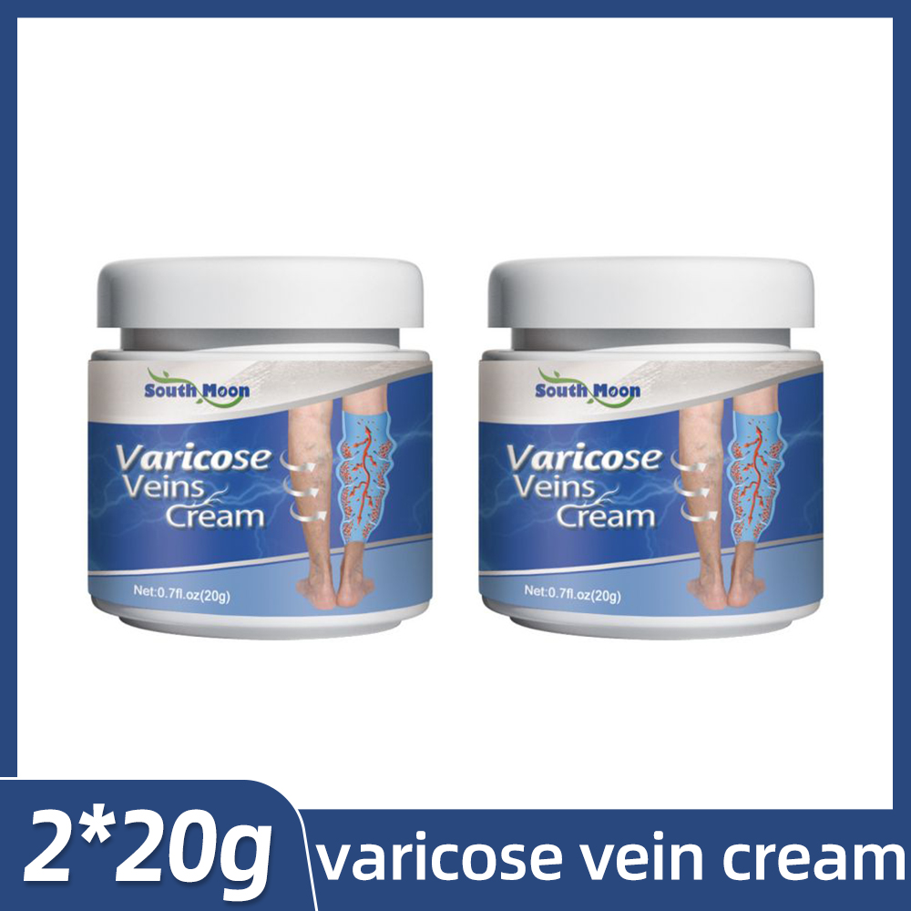 Varicose Vein Removal Cream For Effective Treatment Of Varicose Veins ...