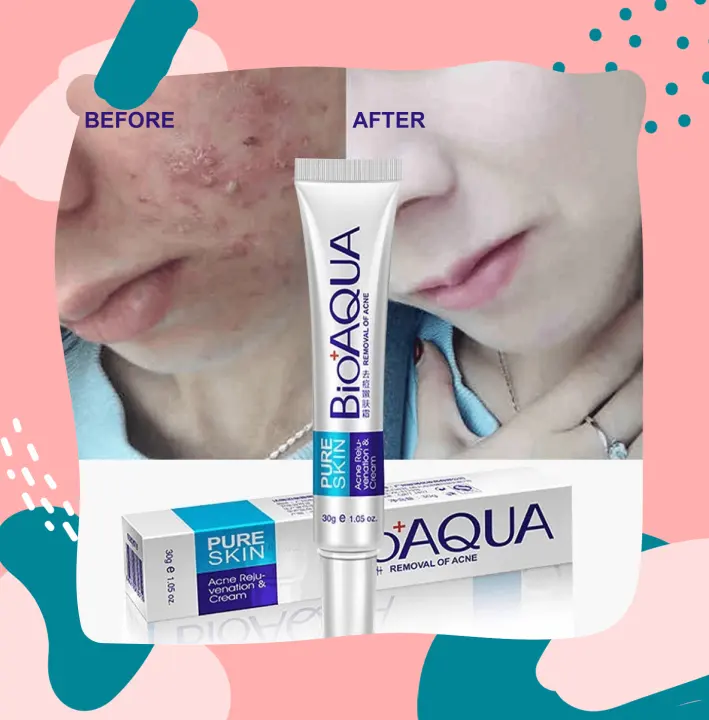 bioaqua blackhead cream