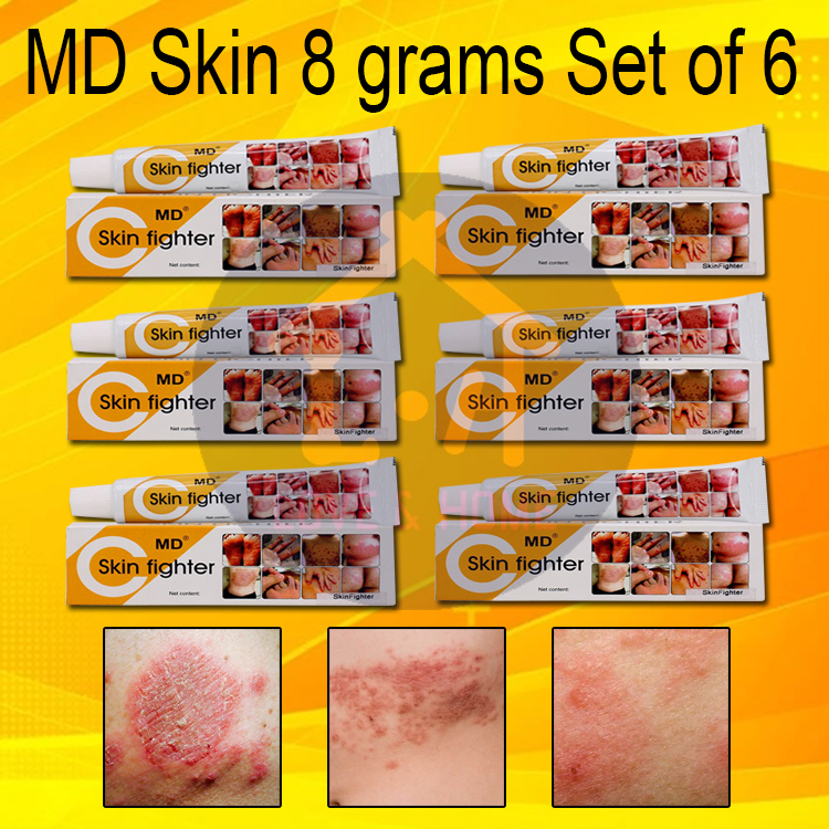 WISER Original MD Skin Fighter Cream for Skin Allergies or Fungis 8g