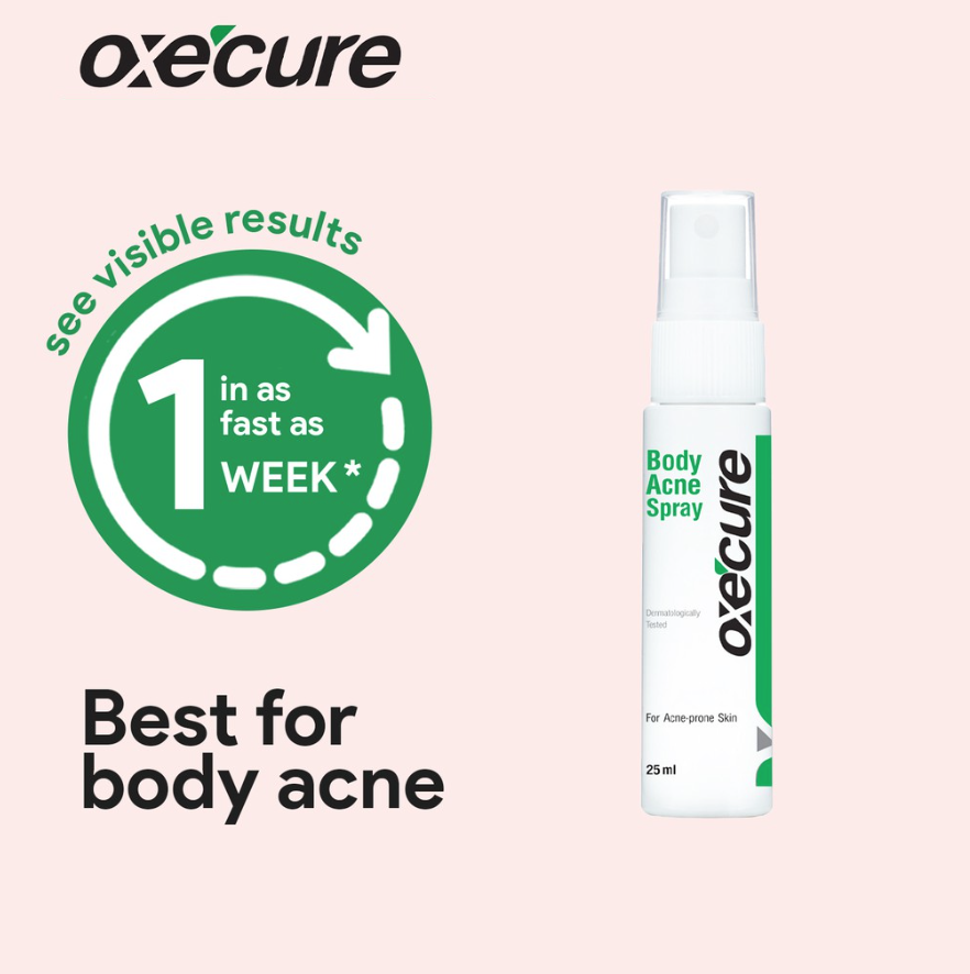 Oxecure Body Acne Spray 25ml Lazada Ph 1617