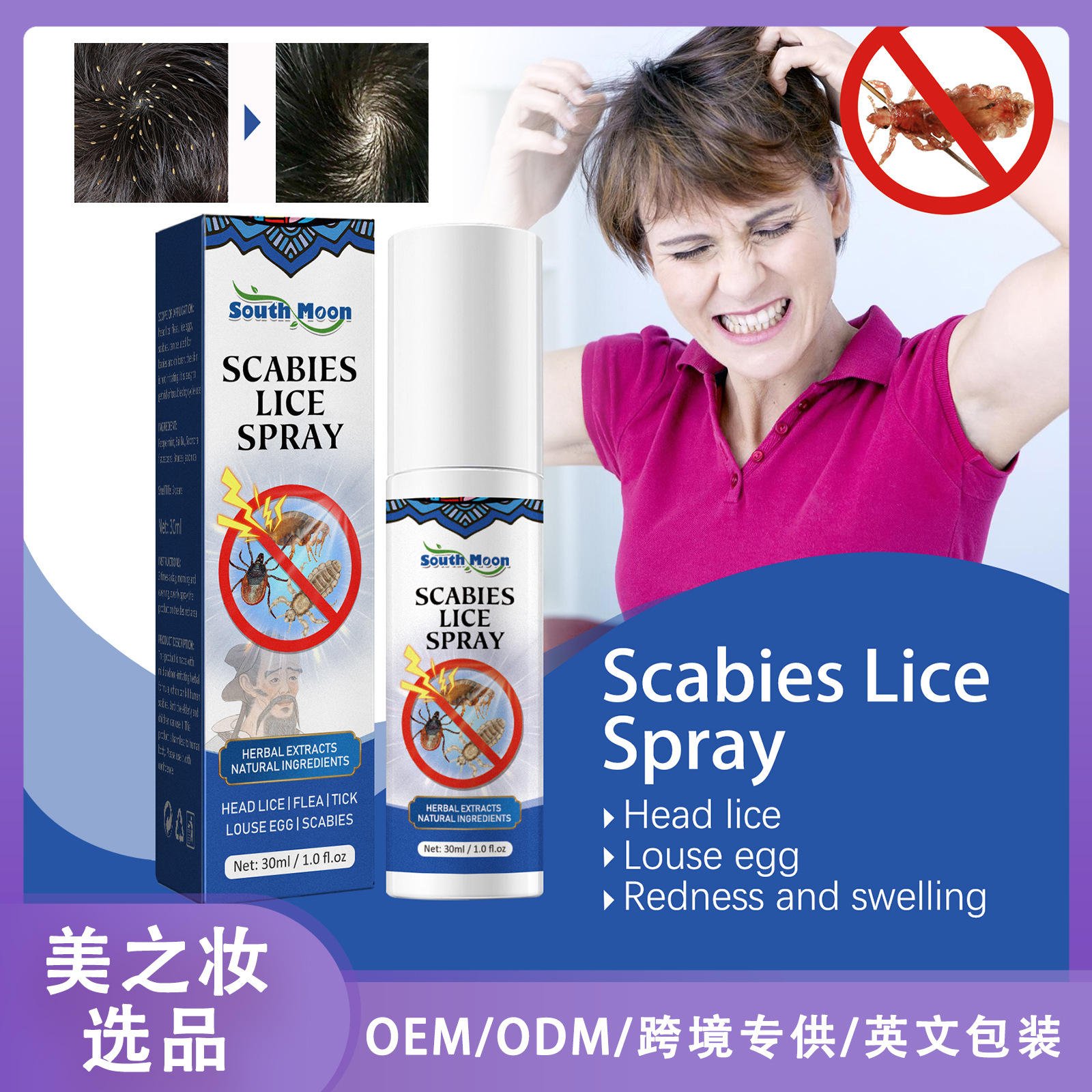 Head Lice Removal Spray Remove Head Lice Crab Louse Scab Scalp AntiItching Spray Scalp Care