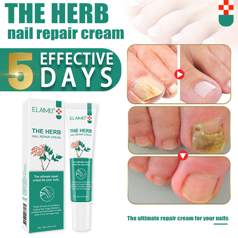 nail fungus treatment nail repair treatment cream footurel gel anti