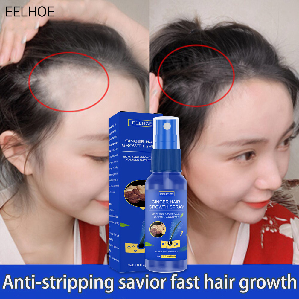 eelhoe-hair-growth-spray-promotes-hair-growth-hair-growth-spray-ginger