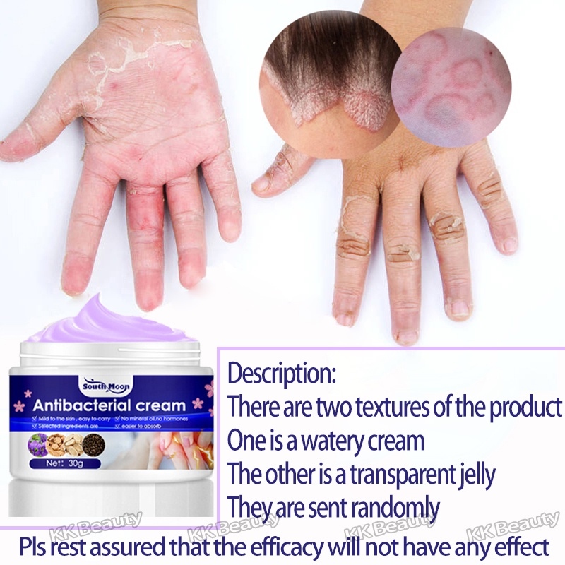 Eczema Cream Effective Itching Sweat Herpes Treatment Ointment for