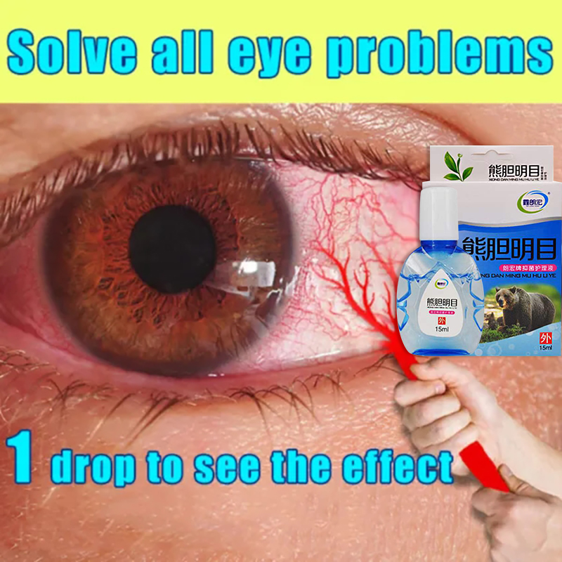 【Restore you vision】Eye Drops Dry Eye AntiFatigue Eye Congestion