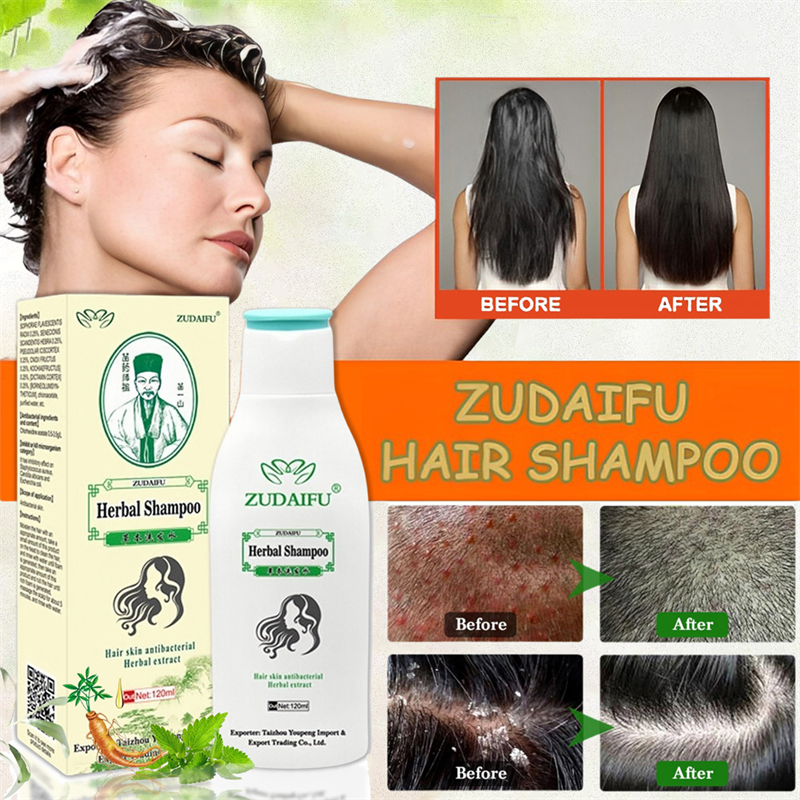 Zudaifu Herbal Shampoo 120ML Treatment Eczema Dermatitis Anti fungal