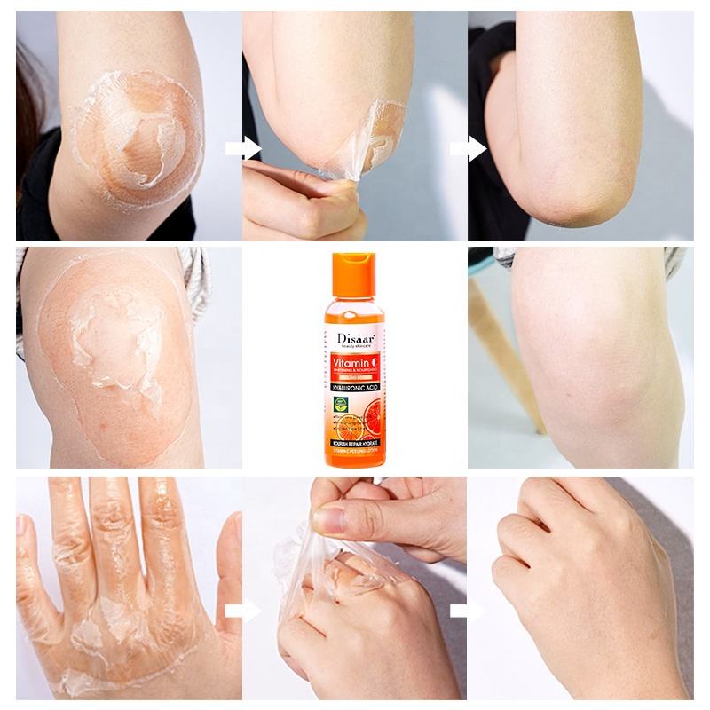 Vitamin C skin whitening body lotion Peeling Skin Lotion 100ml Lazada PH