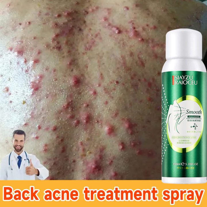Acne Spray Acne Remover For Arms Back And Body Back Acne Treatment Oil