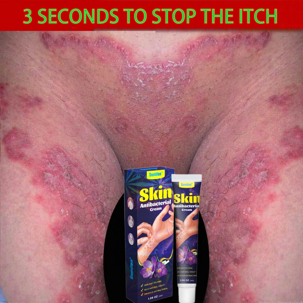 Private Antibacterial Cream Psoriasis Eczema Cream Gamot Sa Kati Kati ...