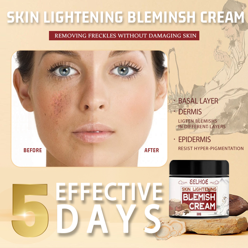 melasma remover from japan effective super collagen melasma remover cream japan original beauty