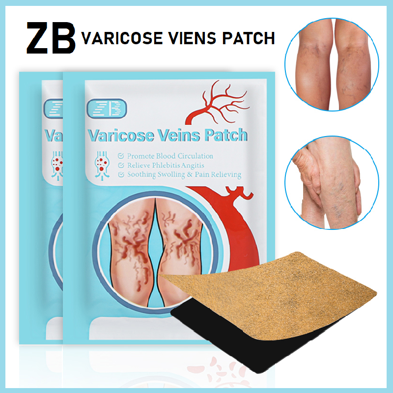 Original ZB Varicose Veins Patch Effective Relief for Legs Pain and