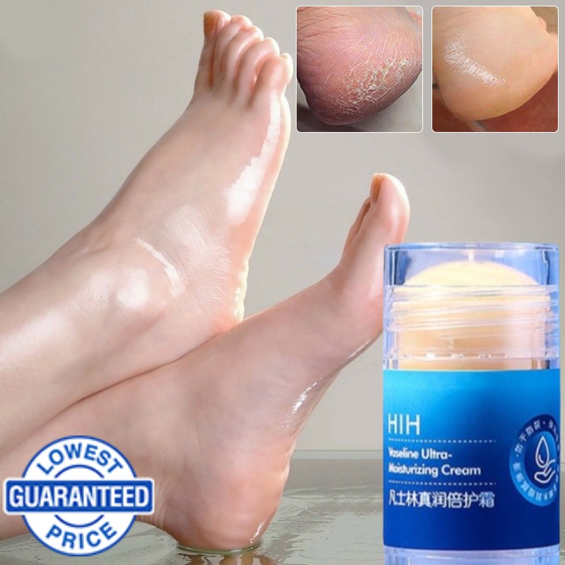 🔥Dream Poem👍HIH Vaseline Foot Cream Anti Crack Moisturizing Whitening  Hand Heel Cream Heel Anti Chapping Moisturizing and Nourishing Protective  Stick Skin care for Body Hand Foot | Lazada PH