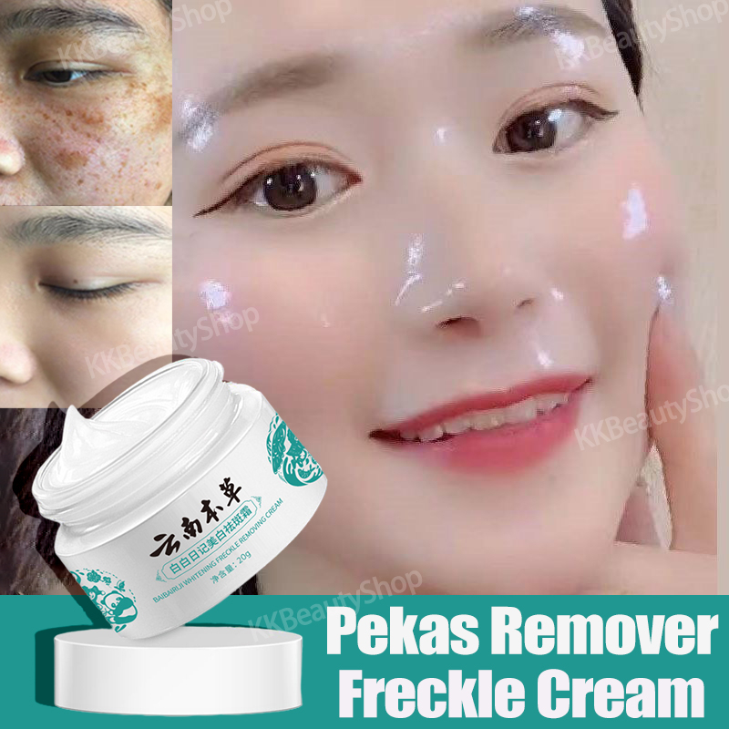 CODPekas Remover Melasma Cream Whitening Freckle Cream Dark Spots