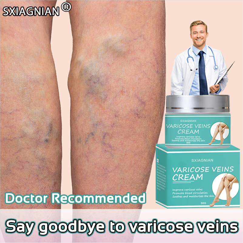 SXIAGNIAN Varicose Vein Cream Phlebitis Relief Leg Vein Spray Angrites