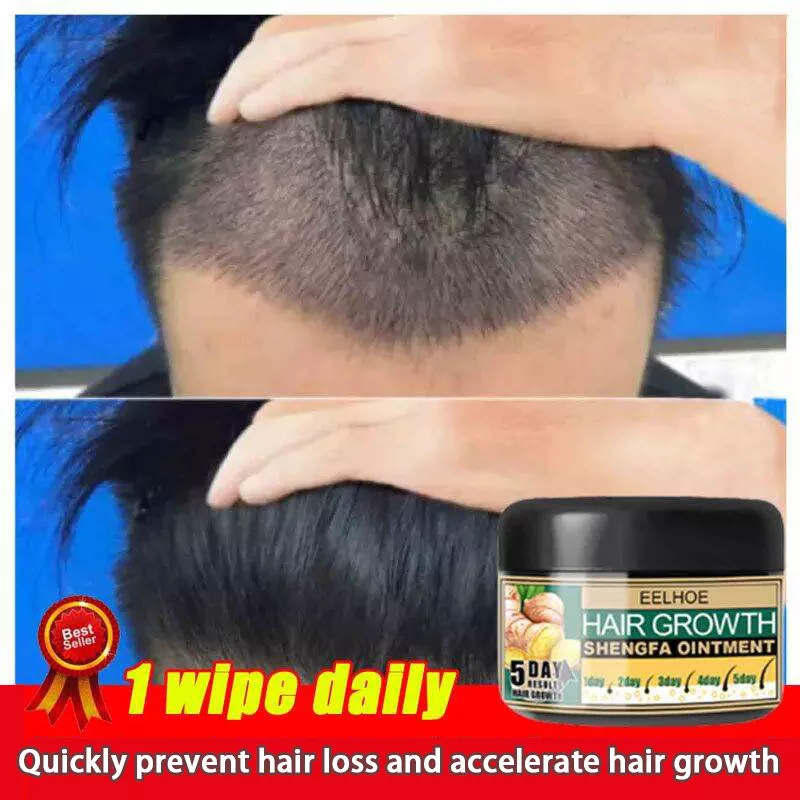 Eelhoe 5 Days Ginger Hair Growth Care Ointment 30g Hair Fast Regrowth