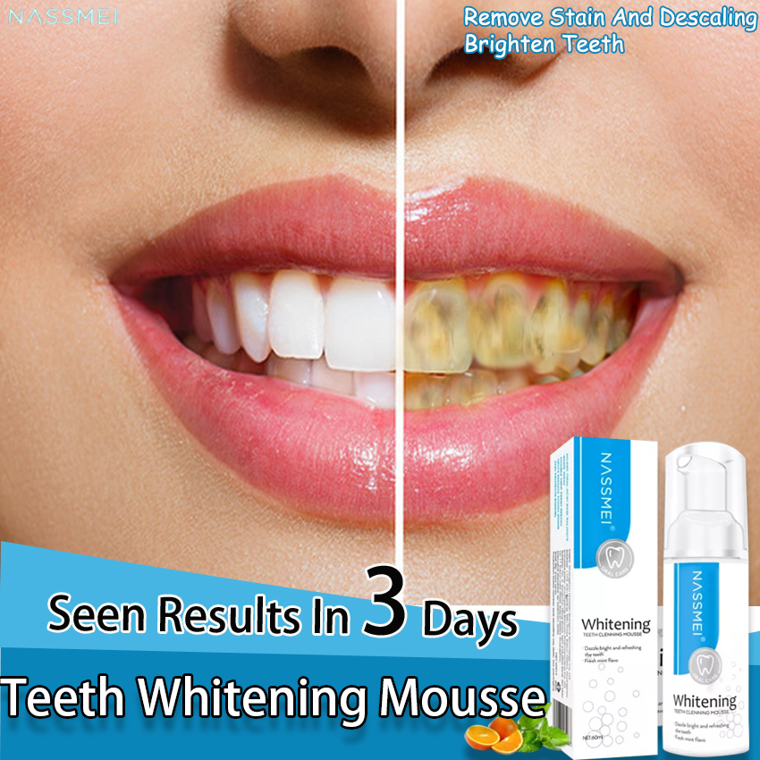 nassmei dental mousse