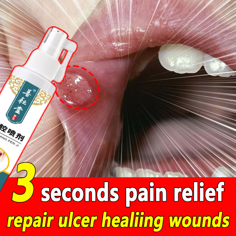 3-seconds-pain-relief-canker-sore-spray-50ml-mouth-ulcer-treatment