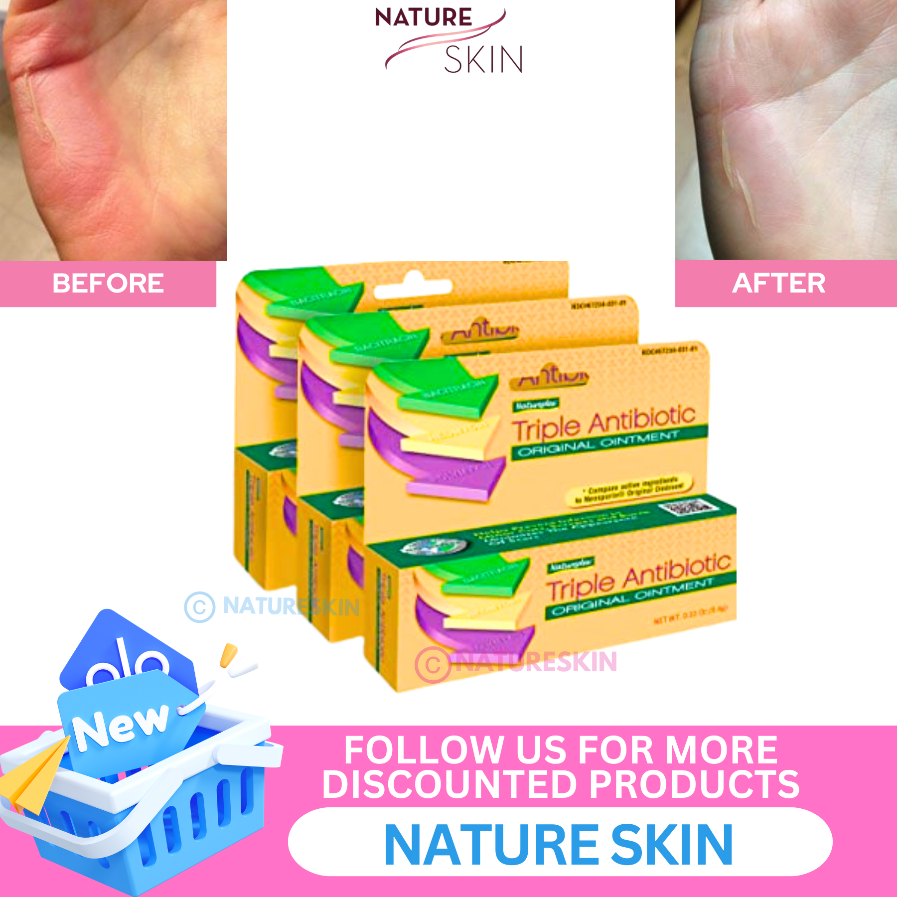 Natureplex Triple Antibiotic Ointment First Aid, Authentic And Triple