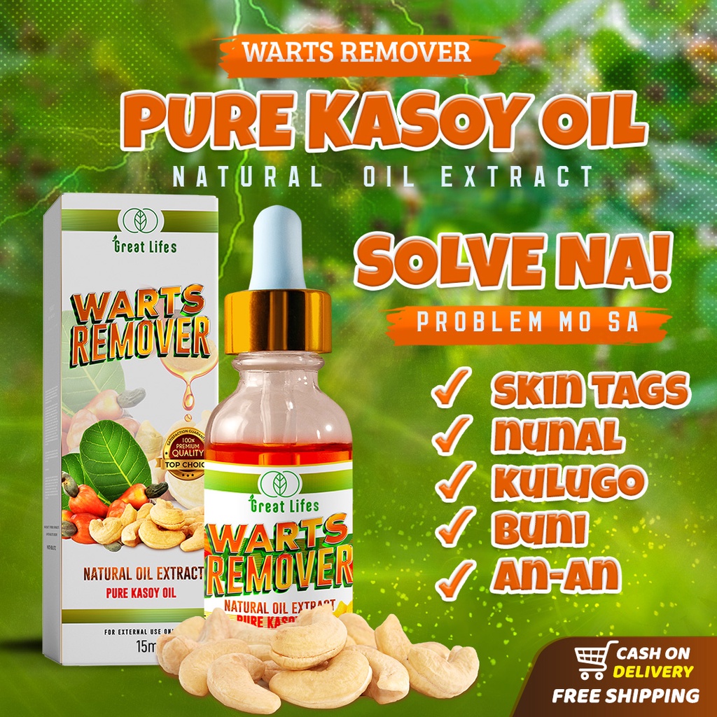 ORIGINAL WARTS REMOVER PURE KASOY OIL 10ML BY GREAT LIFE NATURAL OIL ...