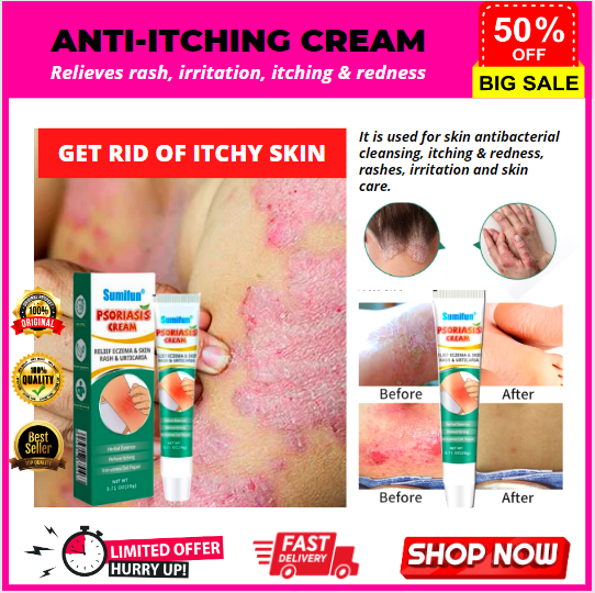 💯 ORIGINAL Guaranteed Effective Psoriasis Cream Ointment Antibacterial ...