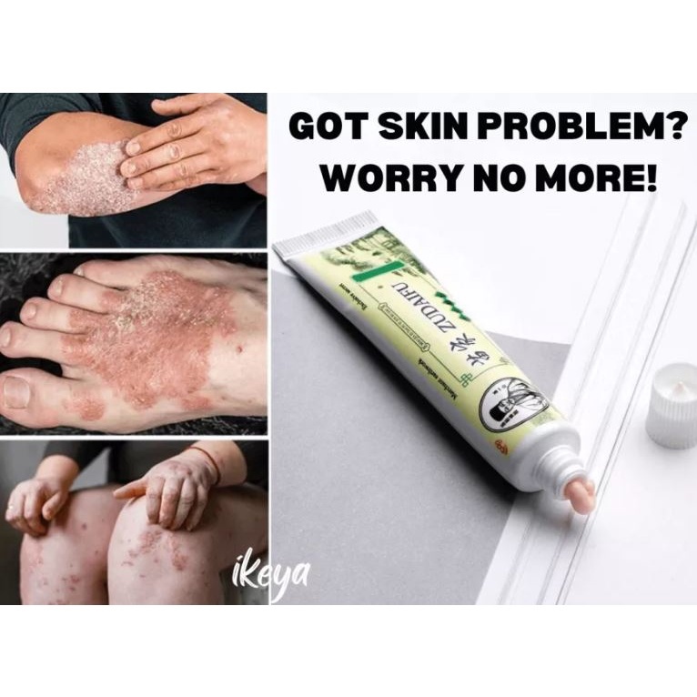 【COD】 100 Organic Herbal Cream Psoriasis Eczema Pruritus Itchiness