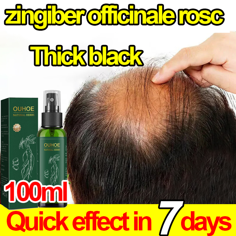 100ML】ginger extract Hair Regrowth Herbal Growth Essence Spray hair growth  oil effectively stimulates rapid hair growth to prevent hair loss thick  hair growth spray organic hair growth fast hair restorer for men