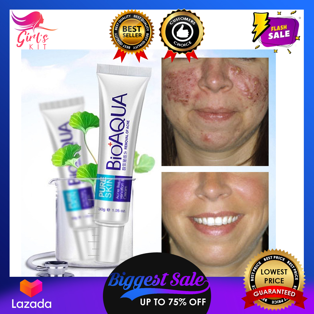 best cream for pimples and acne scars