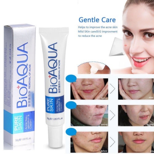 bioaqua face care anti acne pimples cream acne scar removal