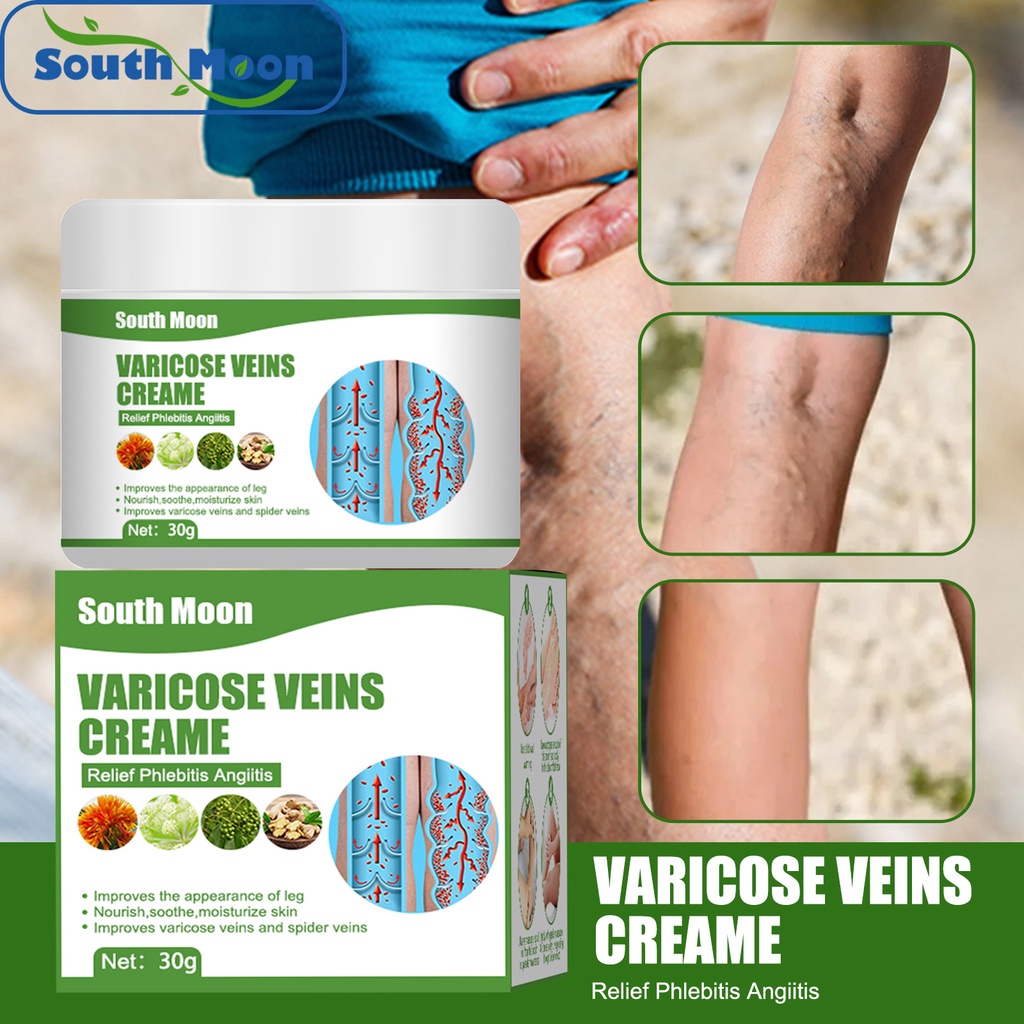 Varicose Veins Treatment Cream Relieve Legs Tired Dilated